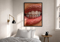 Mouth with Heart Tooth Gems print in a black frame above a bed with striped linens, a brass wall lamp and a sunlit window