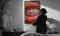 Mouth with Heart Tooth Gems print in a slim black frame being hung on a sunlit wall in a monochrome room