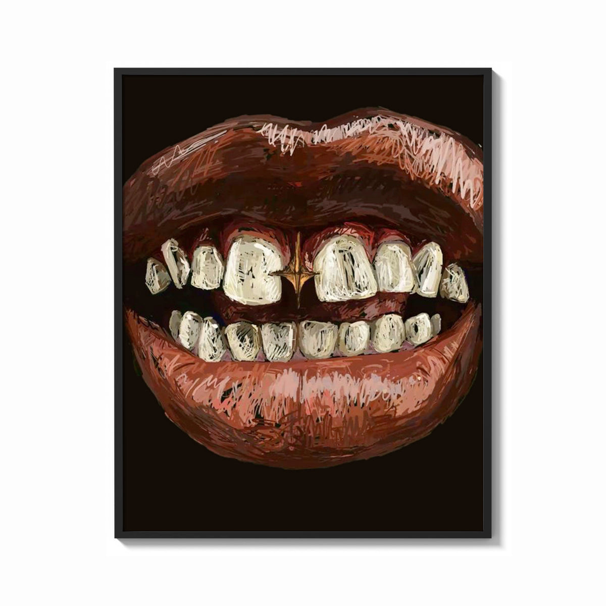 Framed Parted Lips with Gold-Tone Grillz print shown as a bold statement piece on a clean gallery wall