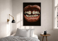 Parted Lips with Gold-Tone Grillz print in a black frame above a bed with striped linens